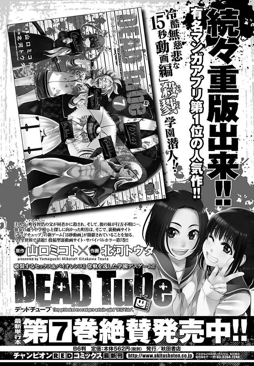 Page 47 Chapter 31 DEAD Tube