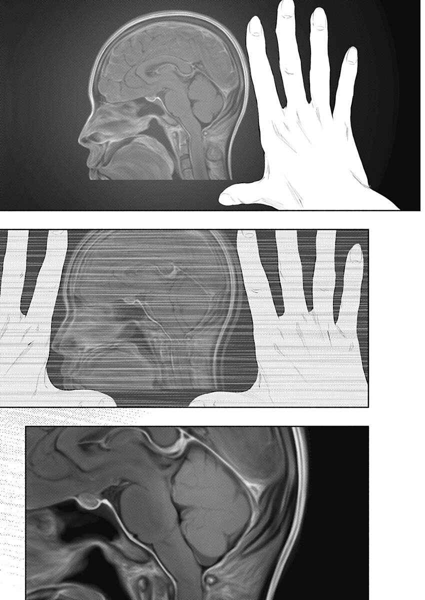 Page 9 Chapter 78 Radiation House