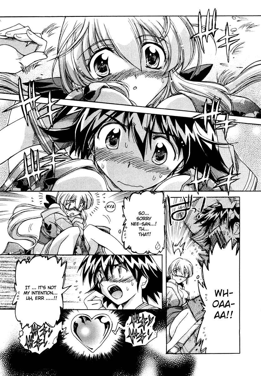 Page 26 Chapter 9 Tsubame Syndrome
